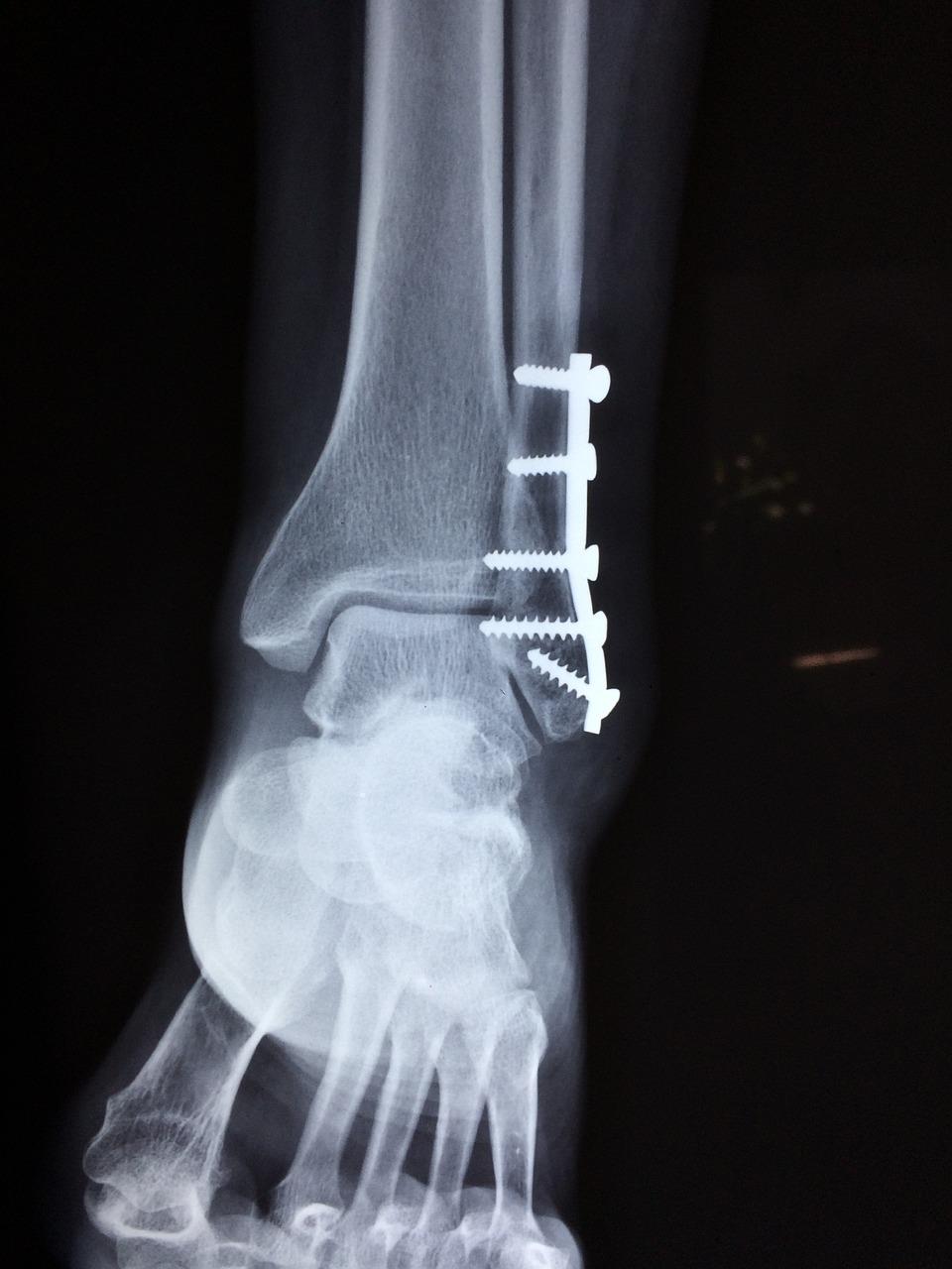 Orthopedie in Purmerend
